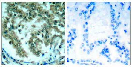 PRKCQ (Ab-676) antibody