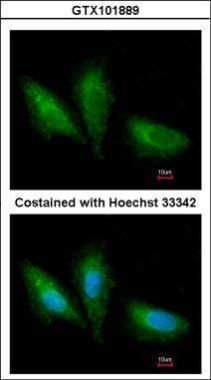 PRKCSH antibody [N1C1]