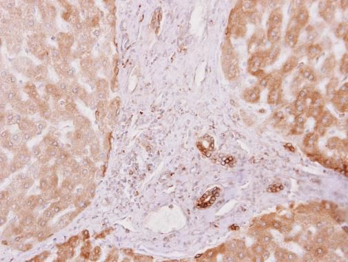PRKCSH antibody [N1C1]