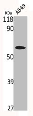 PRKCSH Antibody
