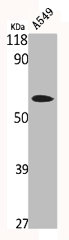 PRKCSH antibody