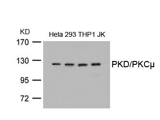 PRKD1 (Ab-738) antibody