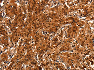 PRKD1 Antibody