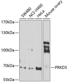 PRKD3 antibody