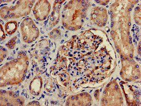 PRKD3 Antibody