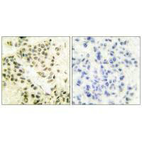 PRKDC antibody