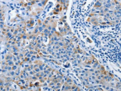 PRKG2 Antibody