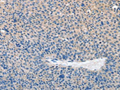 PRKG2 Antibody