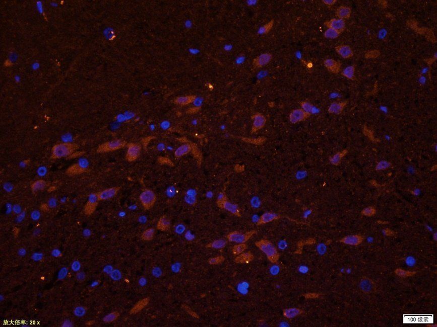 PRKG2 antibody