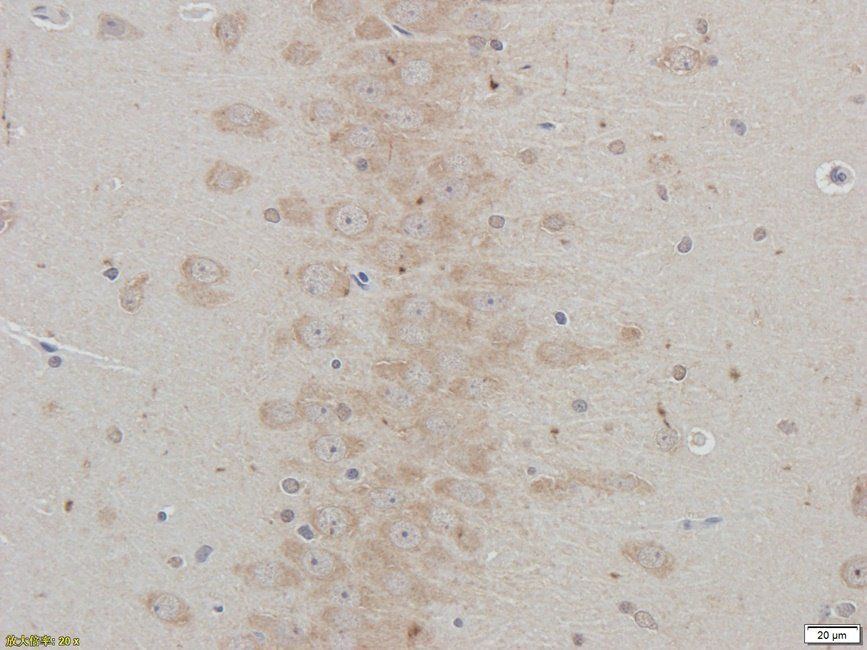 PRKG2 antibody