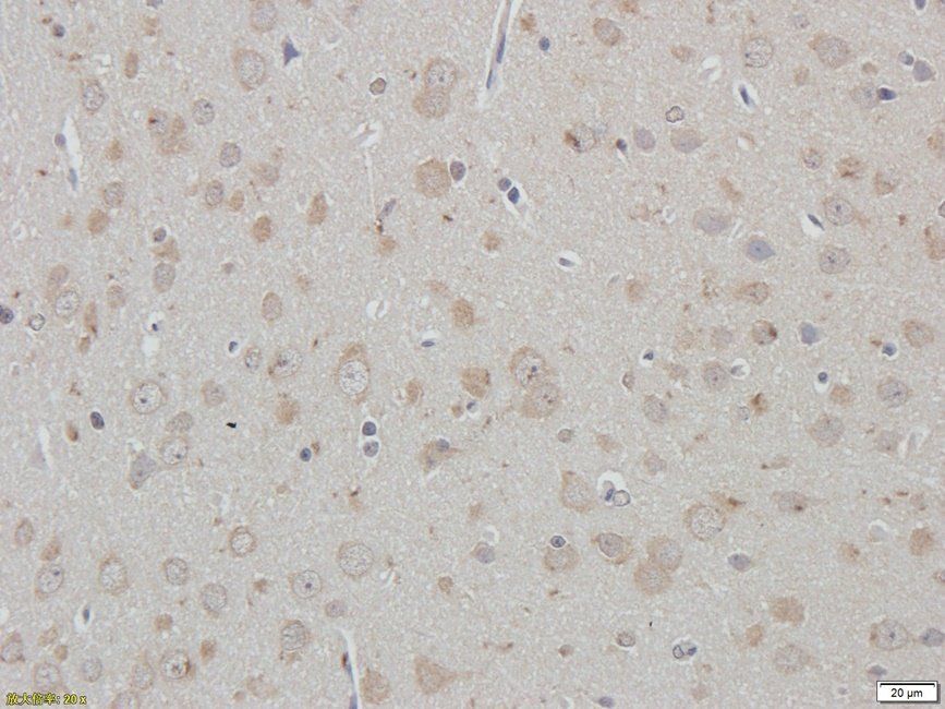 PRKG2 antibody