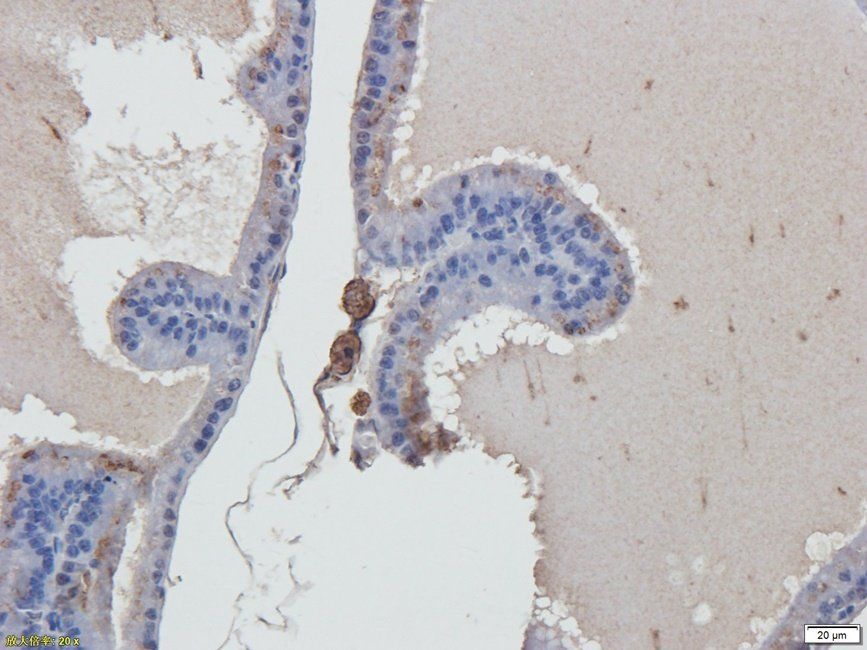 PRKG2 antibody