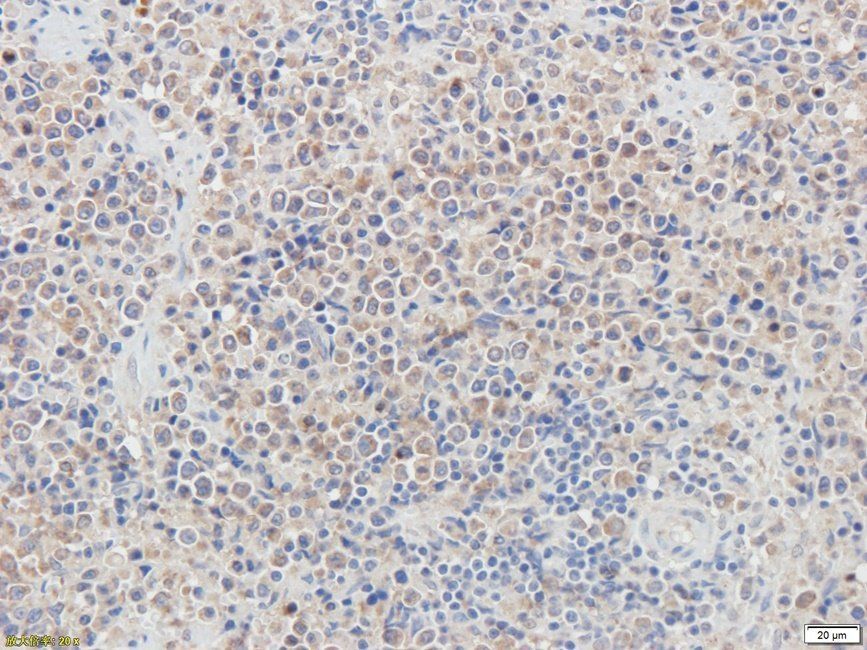 PRKG2 antibody