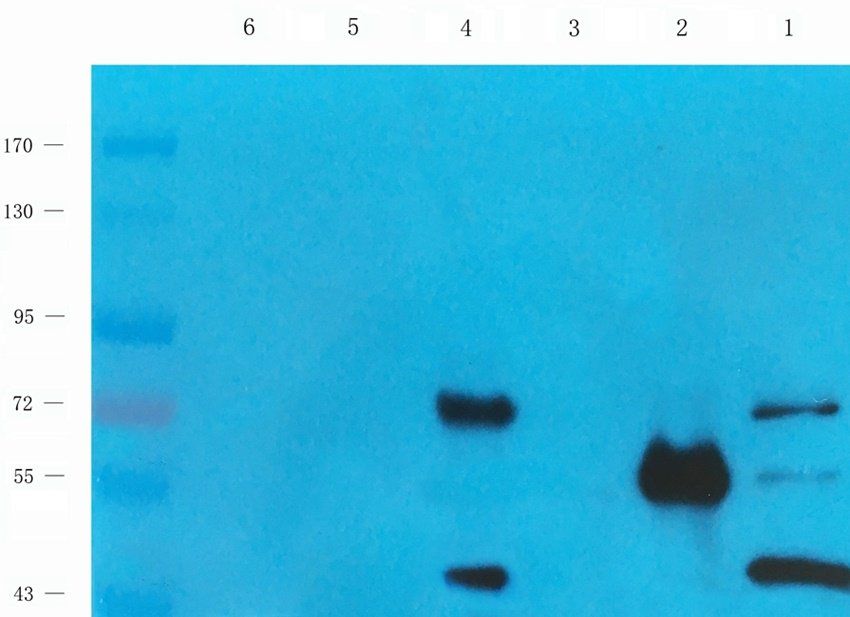 PRKG2 antibody