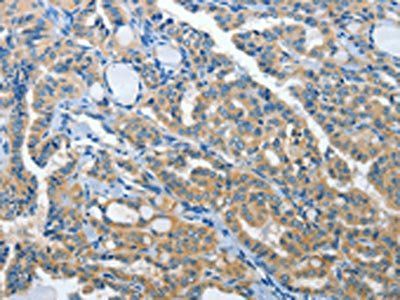 PRKX Antibody