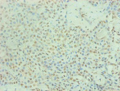 PRL Antibody
