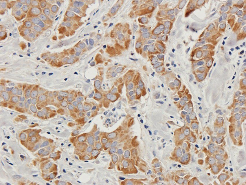 PRLR antibody