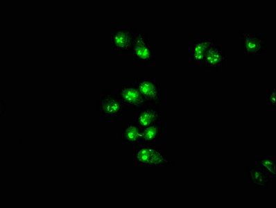 PRMT1 Antibody