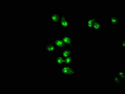 PRMT1 antibody