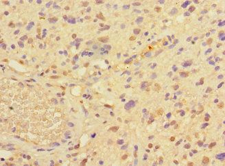 PRMT3 Antibody
