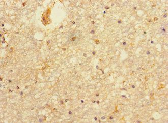 PRMT3 Antibody
