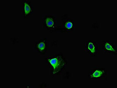 PRMT5 Antibody