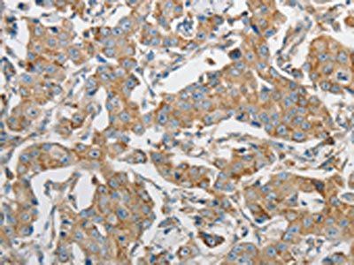 PRMT5 Antibody