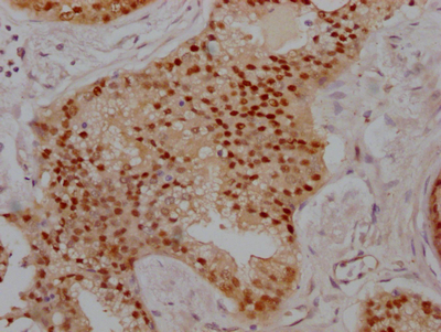 PRMT5 Antibody