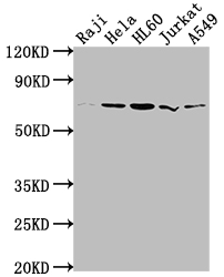 PRMT5 Recombinant Monoclonal Antibody