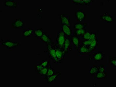 PRMT6 Antibody