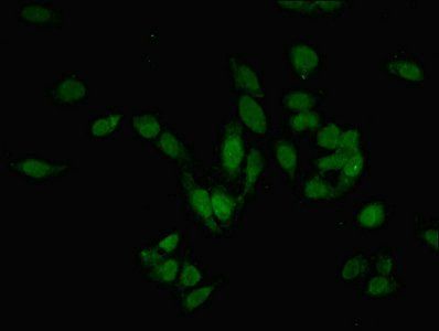 PRMT6 antibody