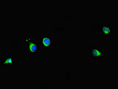 PRMT6 antibody