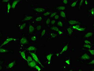 PRMT7 antibody