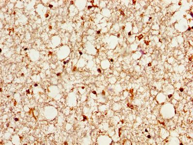 PSAP Antibody