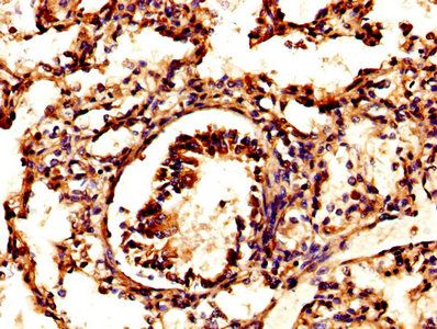 PSAP Antibody