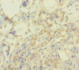 SMARCA2 Antibody