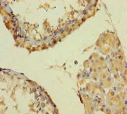 SMARCA2 Antibody