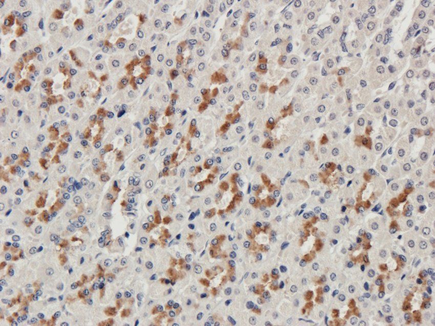 Procollagen type I antibody