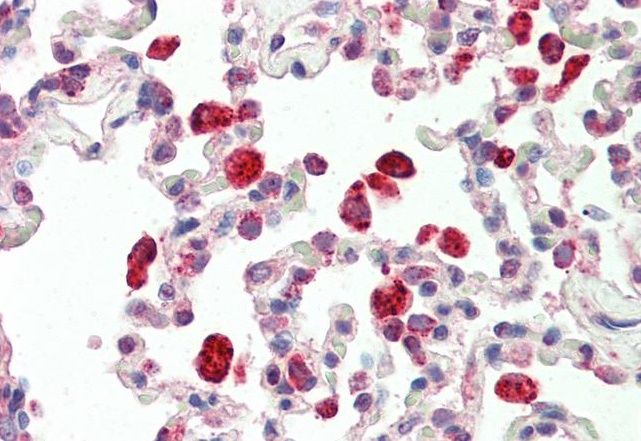 Goat anti-cathepsin C / DPP1 (aa238-252) Antibody