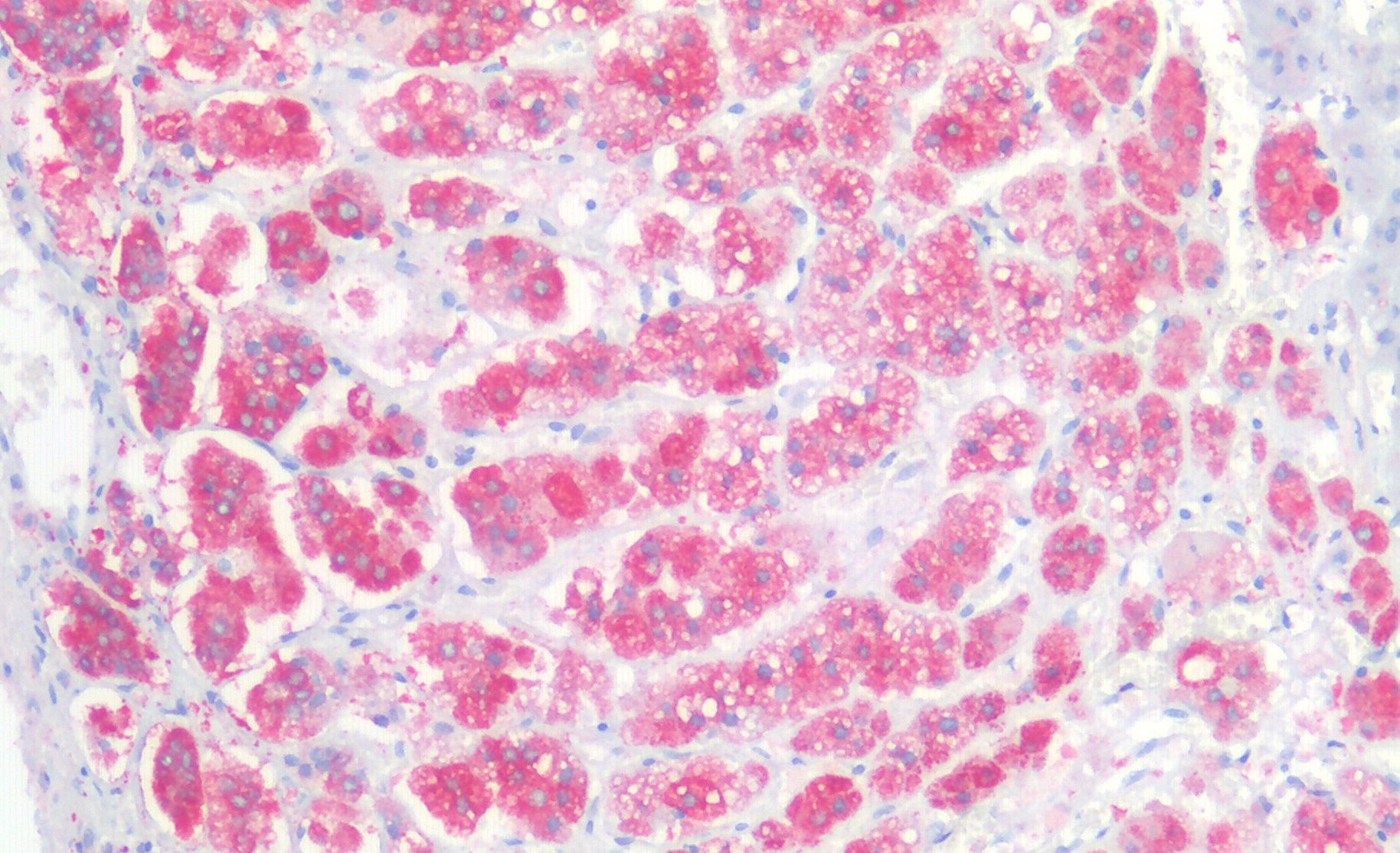 Goat anti-CD56 / NCAM1 (isoform 2) Antibody