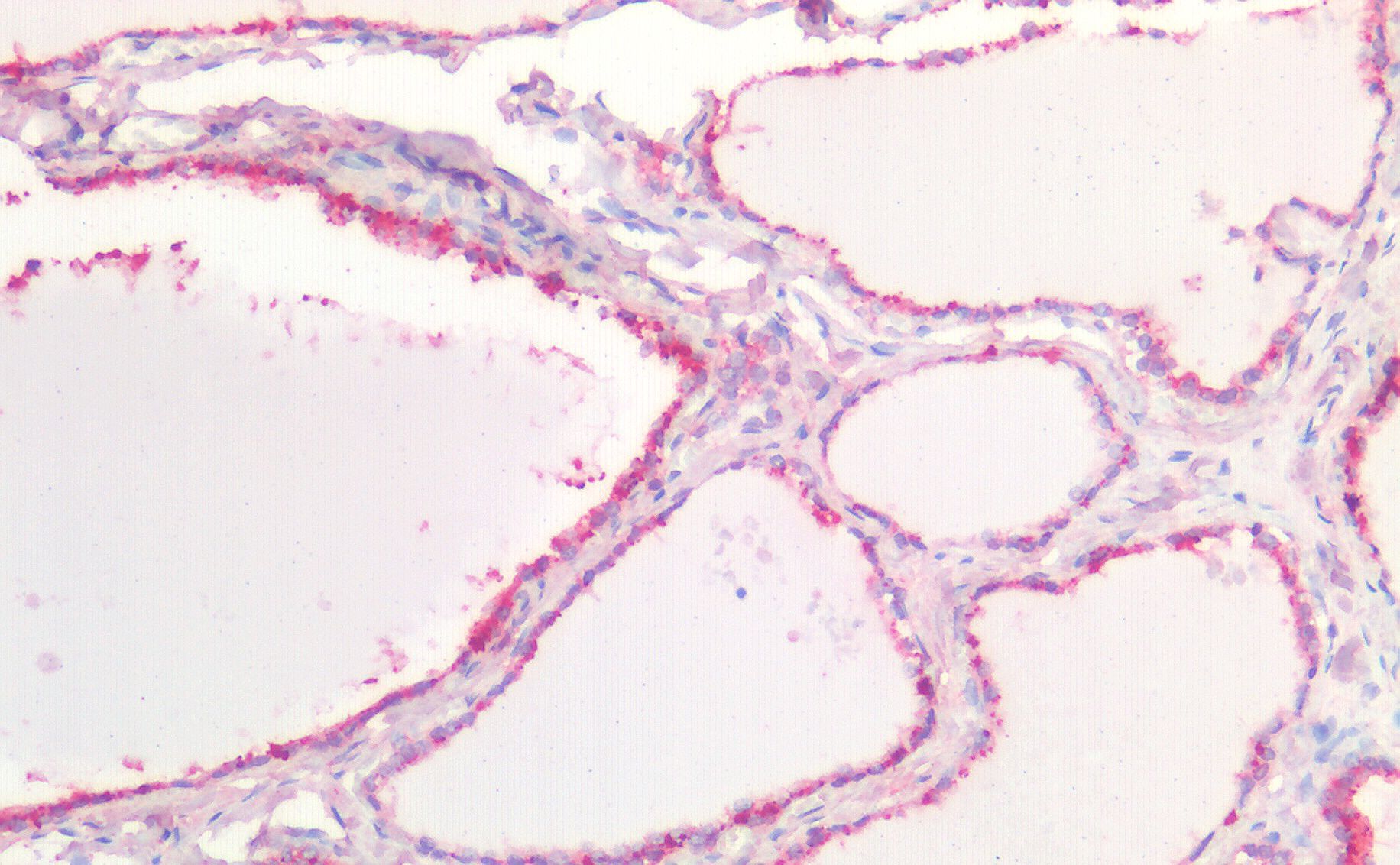 CDH1 antibody