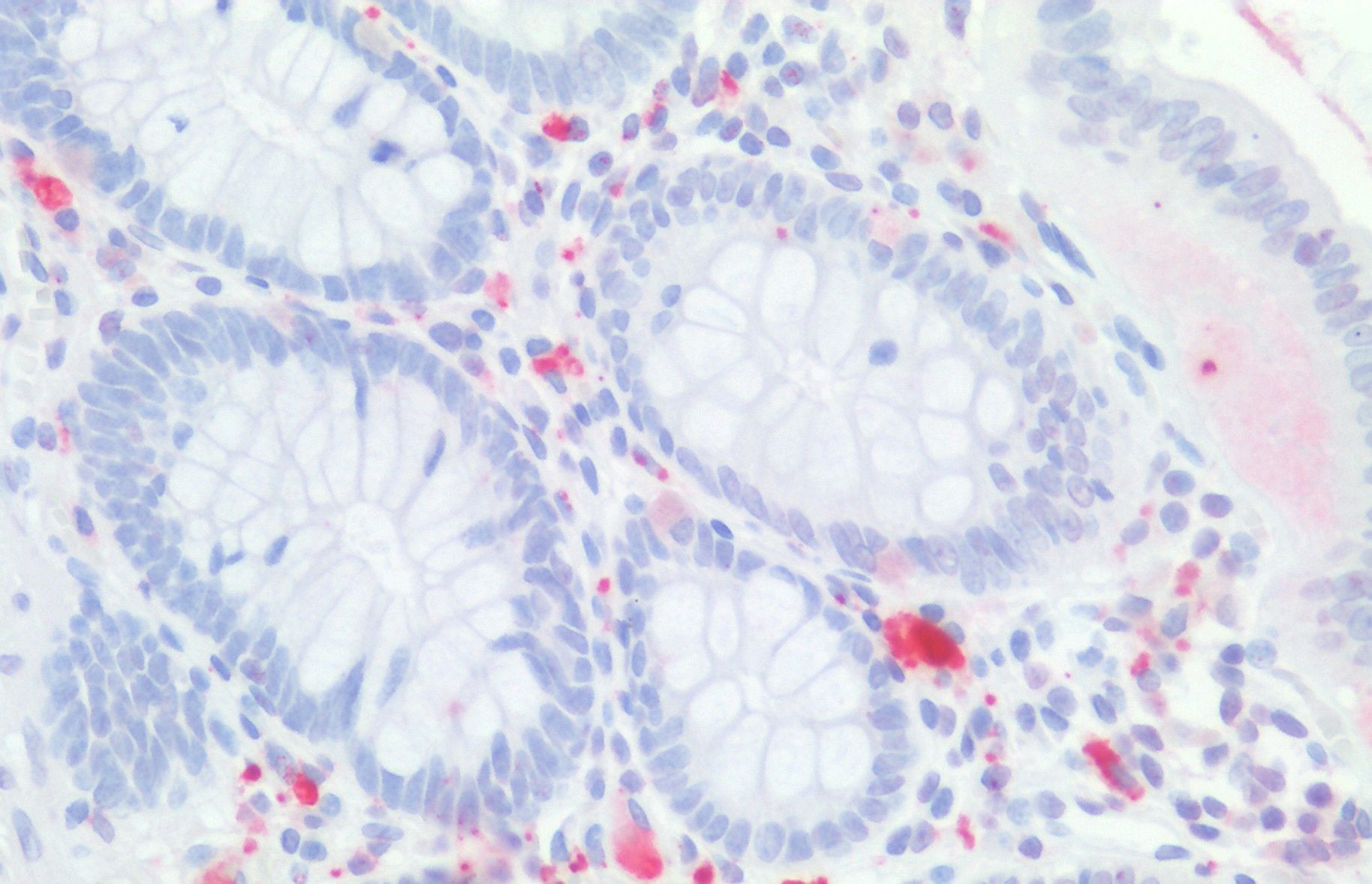 Goat anti-CDX2 Antibody