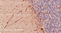 Doublecortin antibody