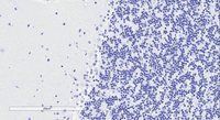 Doublecortin antibody