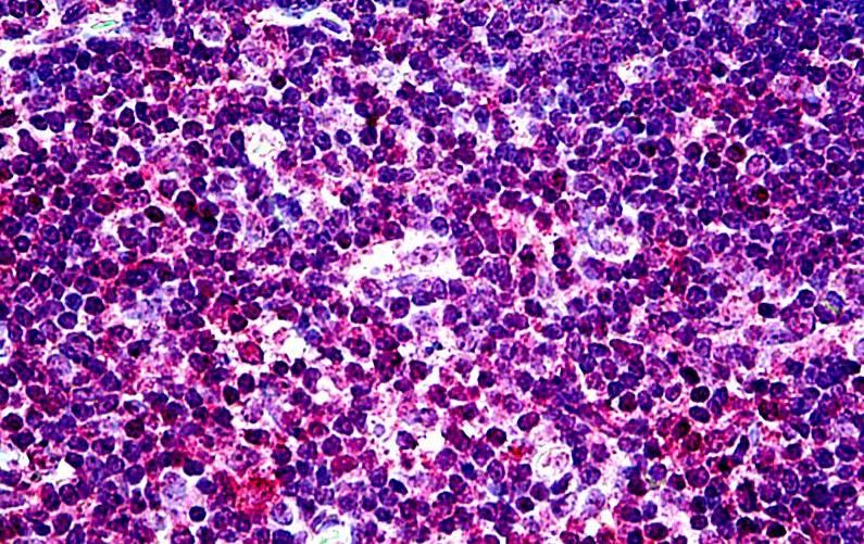 Goat anti-EHD1 Antibody