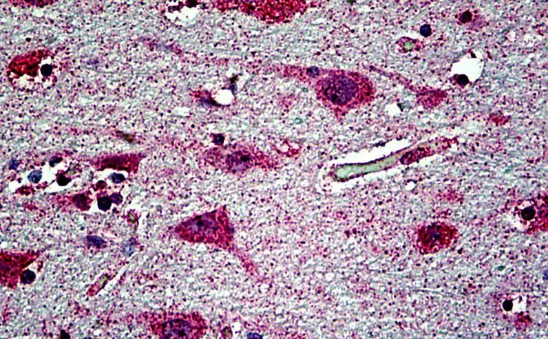 Goat anti-EHD1 Antibody