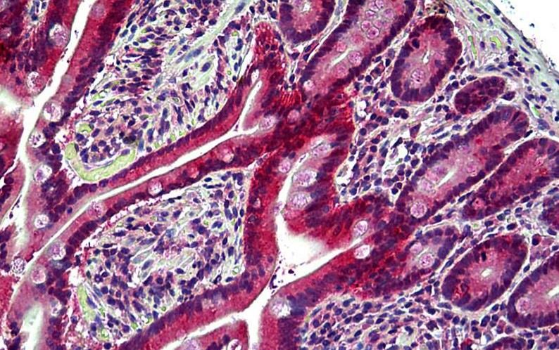 Goat anti-EPHB6 Antibody