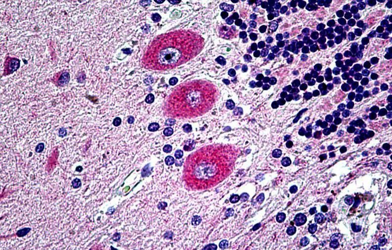 Goat anti-EPHB6 Antibody