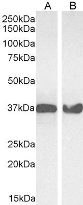 Goat anti-GAPDH (Internal) Antibody