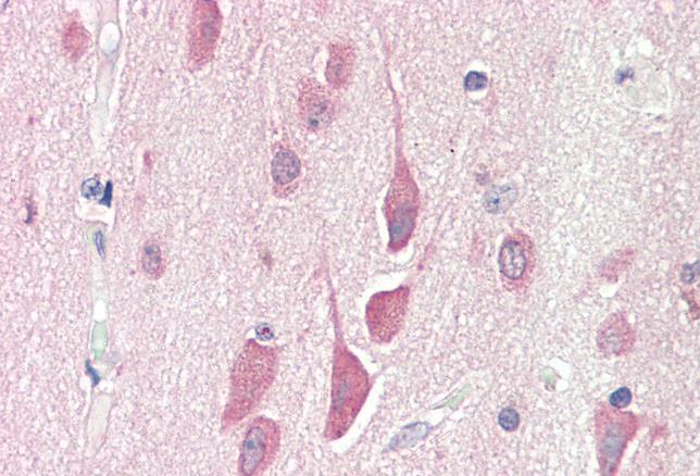 Goat anti-HPS6 Antibody